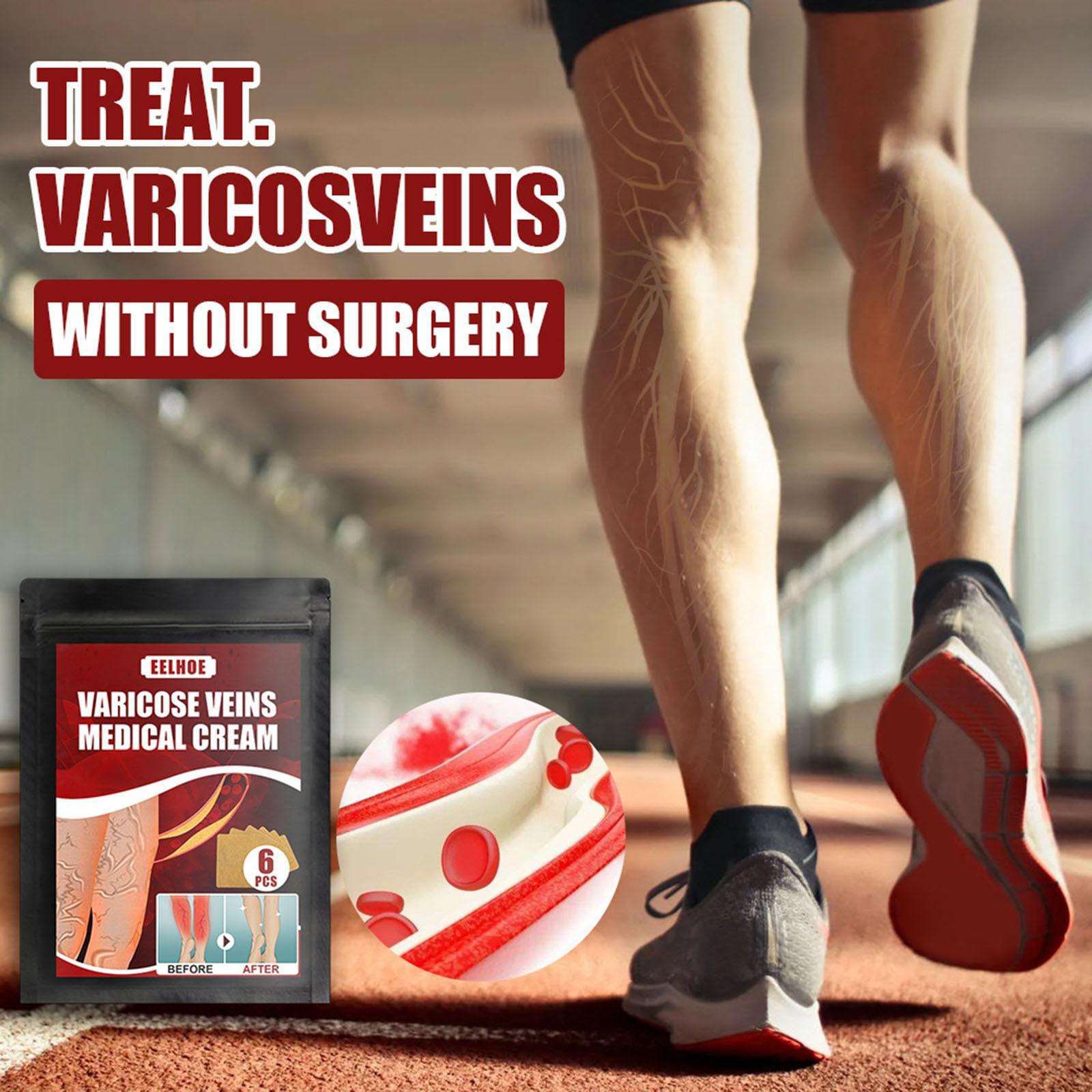6pcs Vein massage varicose leg vein patch with optional pen without pen