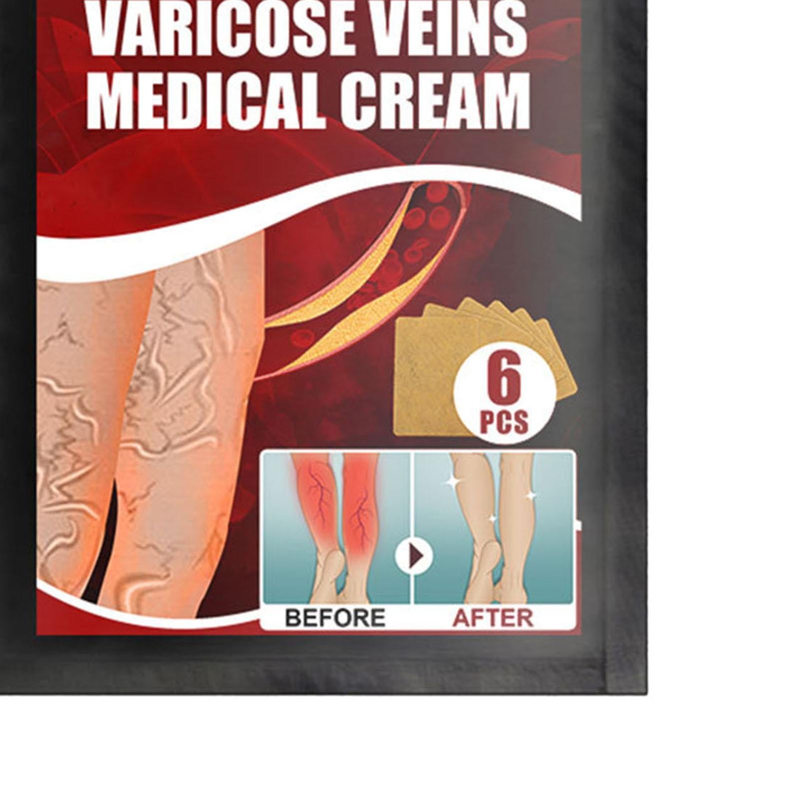 6pcs Vein massage varicose leg vein patch with optional pen without pen